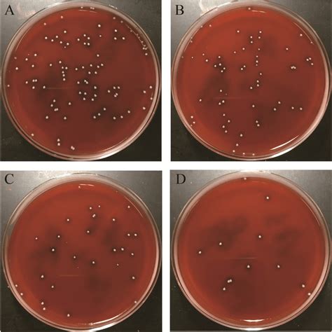 blood agar plate results